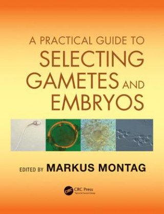 Practical Guide to Selecting Gametes and Embryos