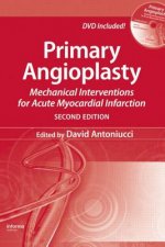 Primary Angioplasty