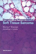 Diagnosis and Management of Soft Tissue Sarcoma