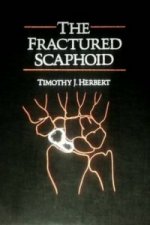 Fractured Scaphoid