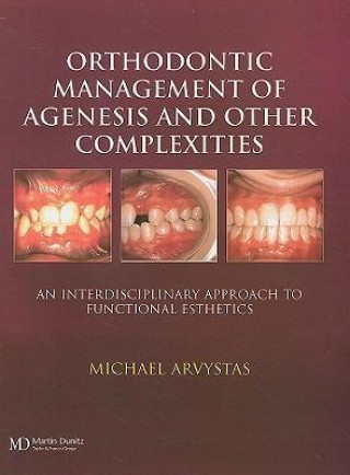 Orthodontic Management of Agenesis and Other Complexities