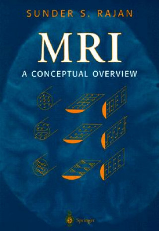 MRI