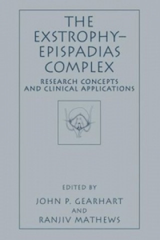 Exstrophy-Epispadias Complex