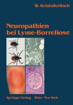 Neuropathien Bei Lyme-Borreliose