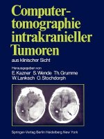 Computertomographie Intrakranieller Tumoren aus Klinischer Sicht