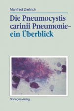 Die Pneumocystis Carinii Pneumonie- ein Uberblick