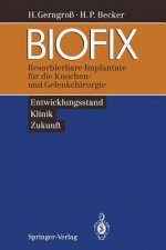 Biofix