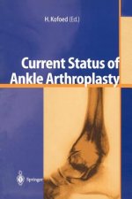 Current Status of Ankle Arthroplasty