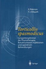 Torticollis spasmodicus