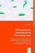 MRT-gestützte laserinduzierte Thermotherapie