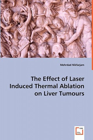 Effect of Laser Induced Thermal Ablation on Liver Tumours
