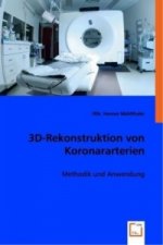 3D-Rekonstruktion von Koronararterien