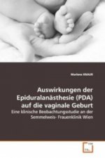 Auswirkungen der Epiduralanästhesie (PDA) auf die vaginale Geburt
