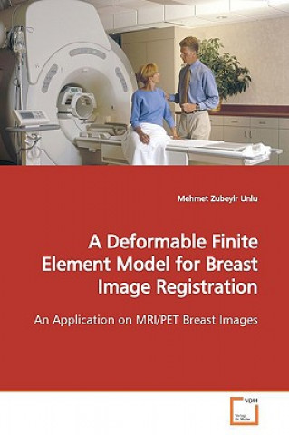 Deformable Finite Element Model for Breast Image Registration