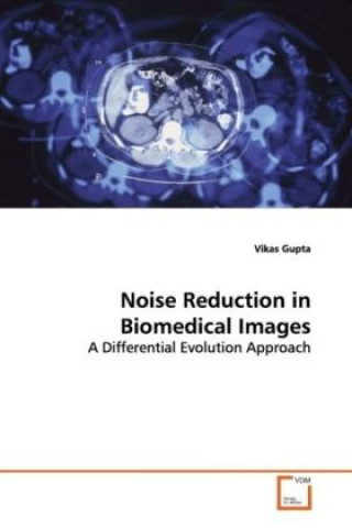 Noise Reduction in Biomedical Images
