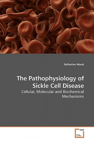 Pathophysiology of Sickle Cell Disease