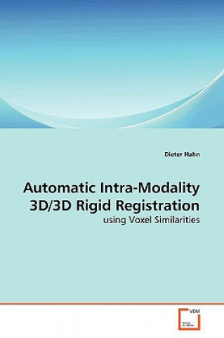 Automatic Intra-Modality 3D/3D Rigid Registration