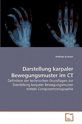 Darstellung karpaler Bewegungsmuster im CT