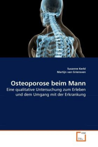 Osteoporose beim Mann