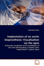 Implantation of an aortic bioprosthesis