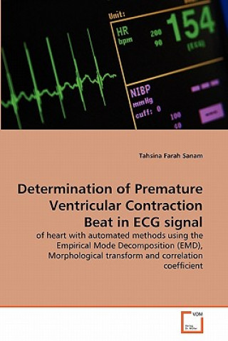 Determination of Premature Ventricular Contraction Beat in ECG signal