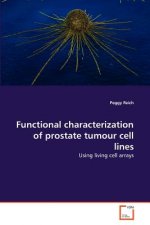 Functional characterization of prostate tumour cell lines