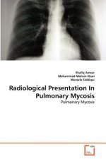 Radiological Presentation In Pulmonary Mycosis