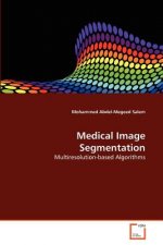 Medical Image Segmentation