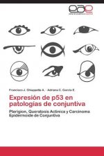 Expresion de P53 En Patologias de Conjuntiva