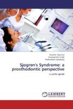 Sjogren's Syndrome: a prosthodontic perspective