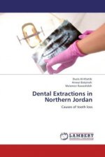 Dental Extractions in Northern Jordan