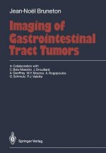 Imaging of Gastrointestinal Tract Tumors