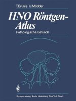 HNO Röntgen-Atlas