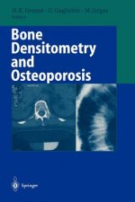 Bone Densitometry and Osteoporosis