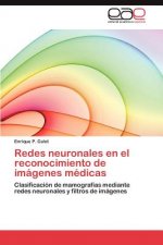 Redes Neuronales En El Reconocimiento de Imagenes Medicas