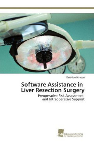 Software Assistance in Liver Resection Surgery