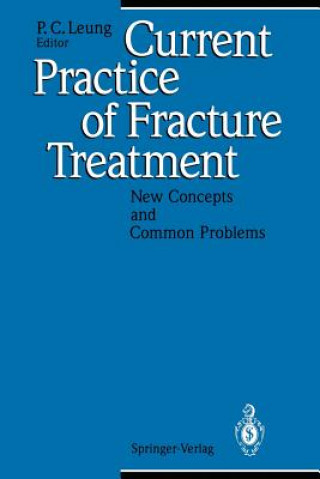 Current Practice of Fracture Treatment