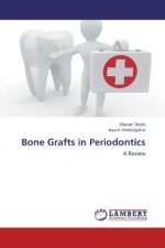 Bone Grafts in Periodontics