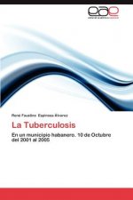 Tuberculosis