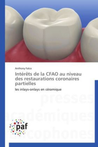 Intér?ts de la CFAO au niveau des restaurations coronaires partielles