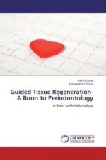 Guided Tissue Regeneration- A Boon to Periodontology