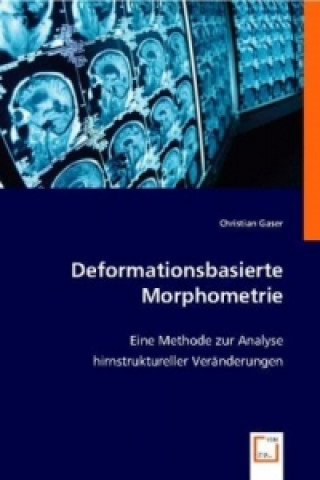 Deformationsbasierte Morphometrie