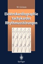 Elektrokardiographie Tachykarder Rhythmusstorungen