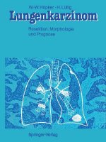 Lungenkarzinom