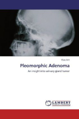 Pleomorphic Adenoma