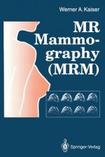 MR Mammography (MRM)