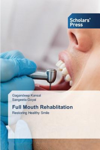 Full Mouth Rehablitation