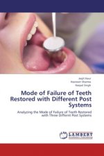 Mode of Failure of Teeth Restored with Different Post Systems