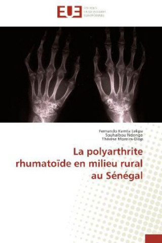La polyarthrite rhumatoïde en milieu rural au Sénégal