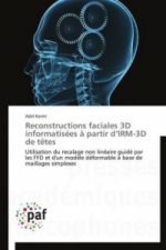 Reconstructions faciales 3D informatisées à partir d IRM-3D de têtes